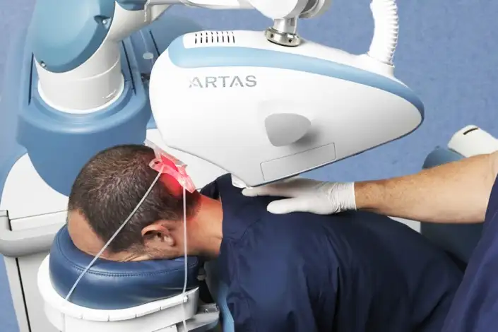 ▷ Transplant Robotic de Păr in Turcia | Implant păr pret