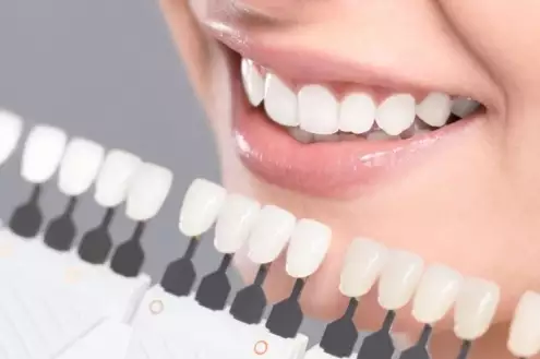Gummy Smile - estetica dentara - te simti mult mai fericit